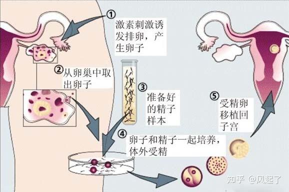 供卵试管哪里做得好(供卵试管哪里做得好？选择最佳的试管供卵中心)